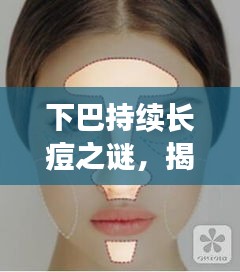 下巴持续长痘之谜，揭秘36岁人群的挑战与应对之道